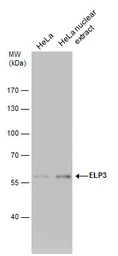 Anti-ELP3 antibody [GT11811] used in Western Blot (WB). GTX631395