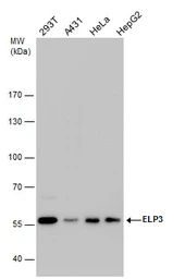 Anti-ELP3 antibody [GT11811] used in Western Blot (WB). GTX631395
