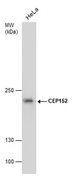 Anti-CEP152 antibody [GT1285] used in Western Blot (WB). GTX631486