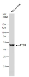 Anti-58K Golgi protein antibody [GT575] used in Western Blot (WB). GTX631588