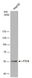 Anti-58K Golgi protein antibody [GT575] used in Western Blot (WB). GTX631588