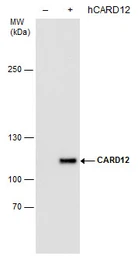 Anti-CARD12 antibody [GT1387] used in Western Blot (WB). GTX631645