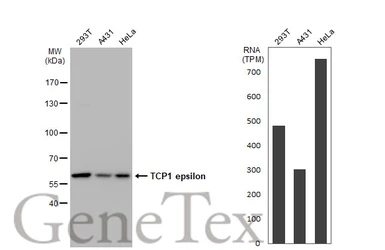 Anti-TCP1 epsilon antibody [GT639] used in Western Blot (WB). GTX631668