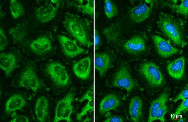 Anti-TCP1 epsilon antibody [GT639] used in Immunocytochemistry/ Immunofluorescence (ICC/IF). GTX631668