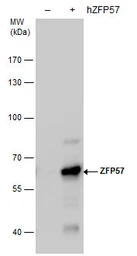 Anti-ZFP57 antibody [GT4512] used in Western Blot (WB). GTX631715