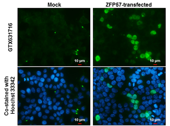 Anti-ZFP57 antibody [GT865] used in Immunocytochemistry/ Immunofluorescence (ICC/IF). GTX631716