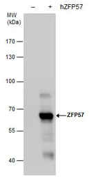 Anti-ZFP57 antibody [GT865] used in Western Blot (WB). GTX631716