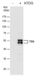 Anti-TDG antibody [GT1511] used in Western Blot (WB). GTX631719