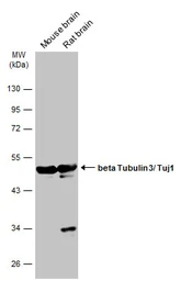 Anti-beta Tubulin 3/ Tuj1 antibody [GT1338] used in Western Blot (WB). GTX631831