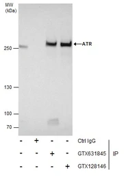 Anti-ATR (phospho Thr1989) antibody [GT222] used in Immunoprecipitation (IP). GTX631845