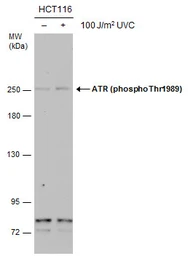Anti-ATR (phospho Thr1989) antibody [GT222] used in Western Blot (WB). GTX631845