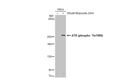 Anti-ATR (phospho Thr1989) antibody [GT222] used in Western Blot (WB). GTX631845