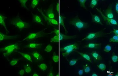 Anti-ATR (phospho Thr1989) antibody [GT222] used in Immunocytochemistry/ Immunofluorescence (ICC/IF). GTX631845