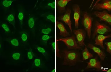 Anti-ATR (phospho Thr1989) antibody [GT222] used in Immunocytochemistry/ Immunofluorescence (ICC/IF). GTX631845