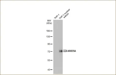 Anti-ARID5A antibody [GT18112] used in Western Blot (WB). GTX631940