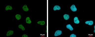 Anti-SA1 antibody [GT8810] used in Immunocytochemistry/ Immunofluorescence (ICC/IF). GTX631989
