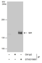 Anti-SA1 antibody [GT8810] used in Immunoprecipitation (IP). GTX631989
