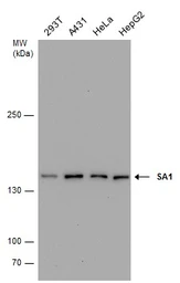 Anti-SA1 antibody [GT8810] used in Western Blot (WB). GTX631989