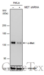 Anti-c-Met antibody [GT556] used in Western Blot (WB). GTX631992