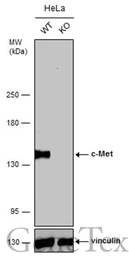 Anti-c-Met antibody [GT556] used in Western Blot (WB). GTX631992