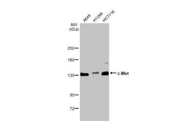 Anti-c-Met antibody [GT556] used in Western Blot (WB). GTX631992