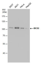 Anti-BICD2 antibody [GT1824] used in Western Blot (WB). GTX631995