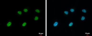 Anti-SA1 antibody [GT1515] used in Immunocytochemistry/ Immunofluorescence (ICC/IF). GTX632010