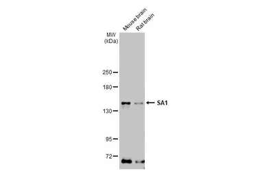 Anti-SA1 antibody [GT1515] used in Western Blot (WB). GTX632010