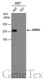 Anti-ARID2 antibody [GT7311] used in Western Blot (WB). GTX632011