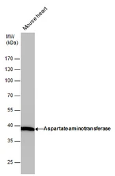 Anti-GOT1 antibody [GT1255] used in Western Blot (WB). GTX632033