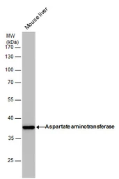 Anti-GOT1 antibody [GT1255] used in Western Blot (WB). GTX632033