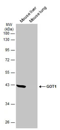 Anti-GOT1 antibody [GT1255] used in Western Blot (WB). GTX632033