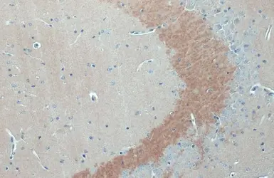 Anti-C9orf72 antibody [GT779] used in IHC (Paraffin sections) (IHC-P). GTX632041