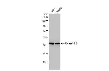Anti-RNaseH2B antibody [GT479] used in Western Blot (WB). GTX632044