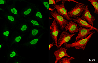 Anti-RNaseH2B antibody [GT479] used in Immunocytochemistry/ Immunofluorescence (ICC/IF). GTX632044