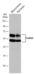 Anti-CaMKII antibody [GT4811] used in Western Blot (WB). GTX632127
