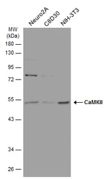 Anti-CaMKII antibody [GT4811] used in Western Blot (WB). GTX632127