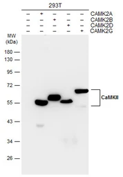 Anti-CaMKII antibody [GT4811] used in Western Blot (WB). GTX632127
