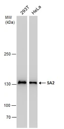 Anti-SA2 antibody [GT1417] used in Western Blot (WB). GTX632129