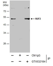 Anti-NUF2 antibody [GT644] used in Immunoprecipitation (IP). GTX632184