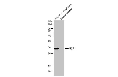 Anti-UCP1 antibody [GT1345] used in Western Blot (WB). GTX632186