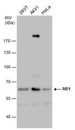 Anti-ME1 antibody [GT736] used in Western Blot (WB). GTX632188