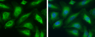Anti-ME1 antibody [GT736] used in Immunocytochemistry/ Immunofluorescence (ICC/IF). GTX632188