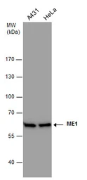 Anti-ME1 antibody [GT979] used in Western Blot (WB). GTX632189
