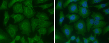Anti-ME1 antibody [GT979] used in Immunocytochemistry/ Immunofluorescence (ICC/IF). GTX632189