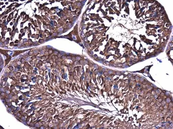 Anti-ME1 antibody [GT979] used in IHC (Paraffin sections) (IHC-P). GTX632189