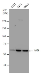 Anti-ME1 antibody [GT15611] used in Western Blot (WB). GTX632190