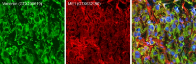 Anti-ME1 antibody [GT15611] used in IHC (Frozen sections) (IHC-Fr). GTX632190