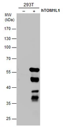 Anti-TOM1L1 antibody [3F12] used in Western Blot (WB). GTX632246