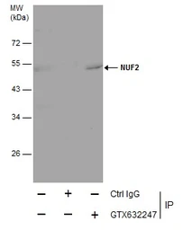 Anti-NUF2 antibody [GT312] used in Immunoprecipitation (IP). GTX632247
